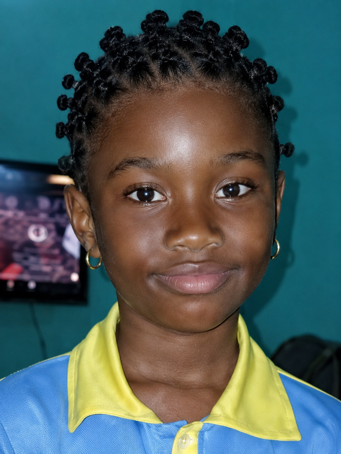 Mariam, niña de 9 años que necesita una operación urgente en Guinea-Conakry